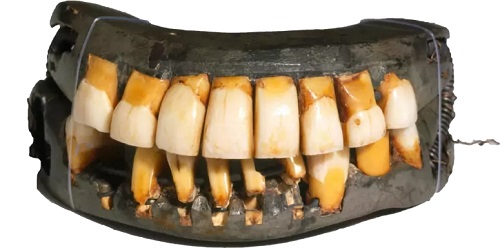 Washington teeth